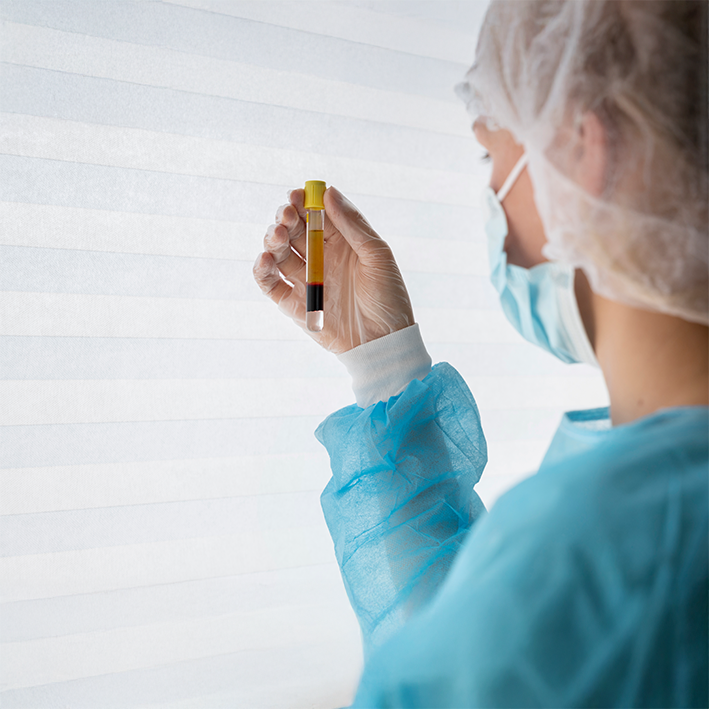 ΛΙΠΙΔΑΙΜΙΚΟΣ ΕΛΕΓΧΟΣ